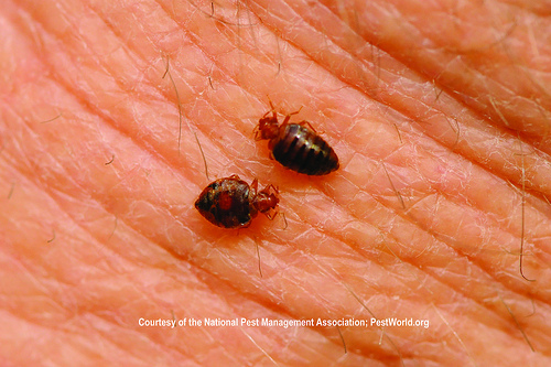 Bedbug Bite May Be More Serious Than Originally Thought, Flickr: Medill DC